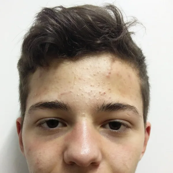 Miguel Ângelo Loureiro Dos Santos